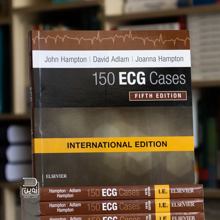 150 ECG Cases 5th Edition