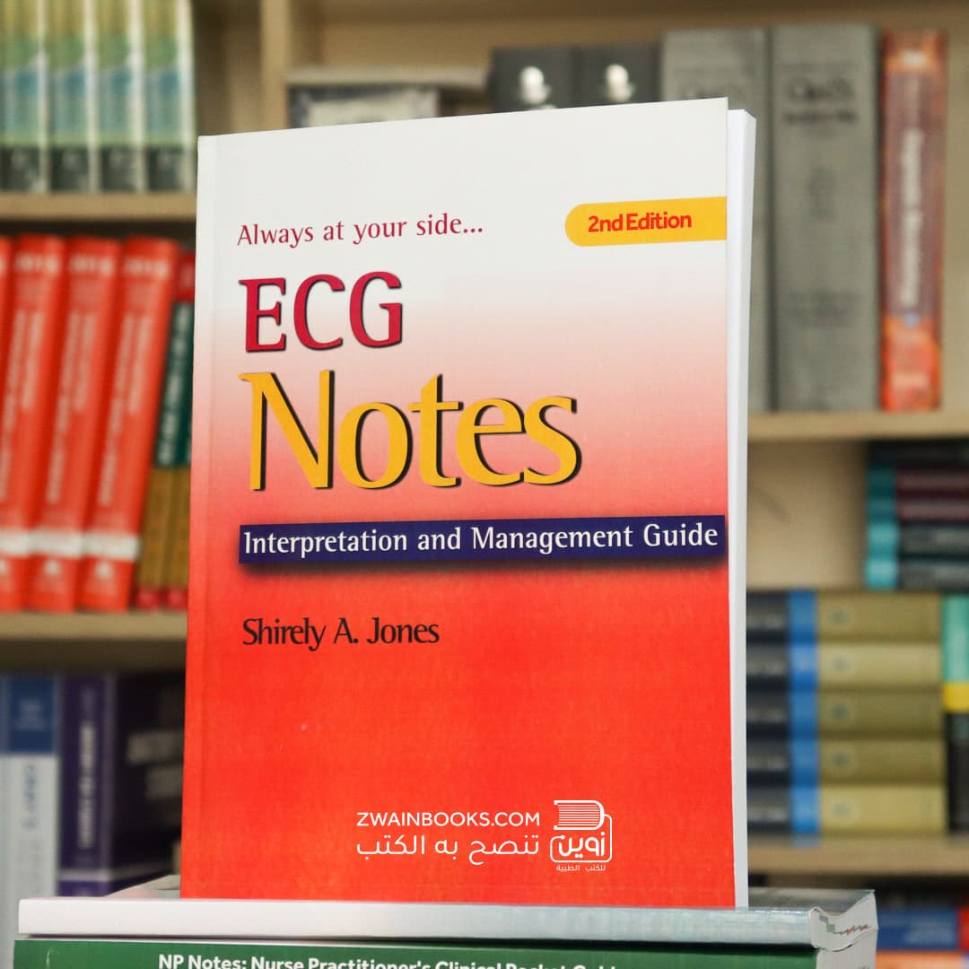 ECG Notes 2nd Edition