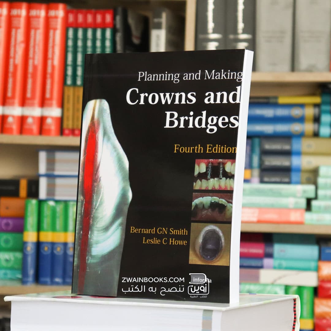 Planning and Making Crowns and Bridges 4th Edition
