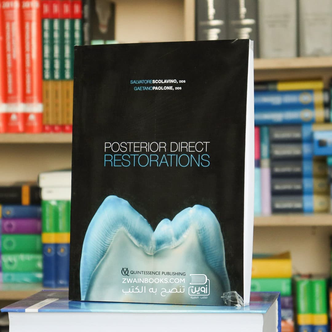 Posterior Direct Restorations