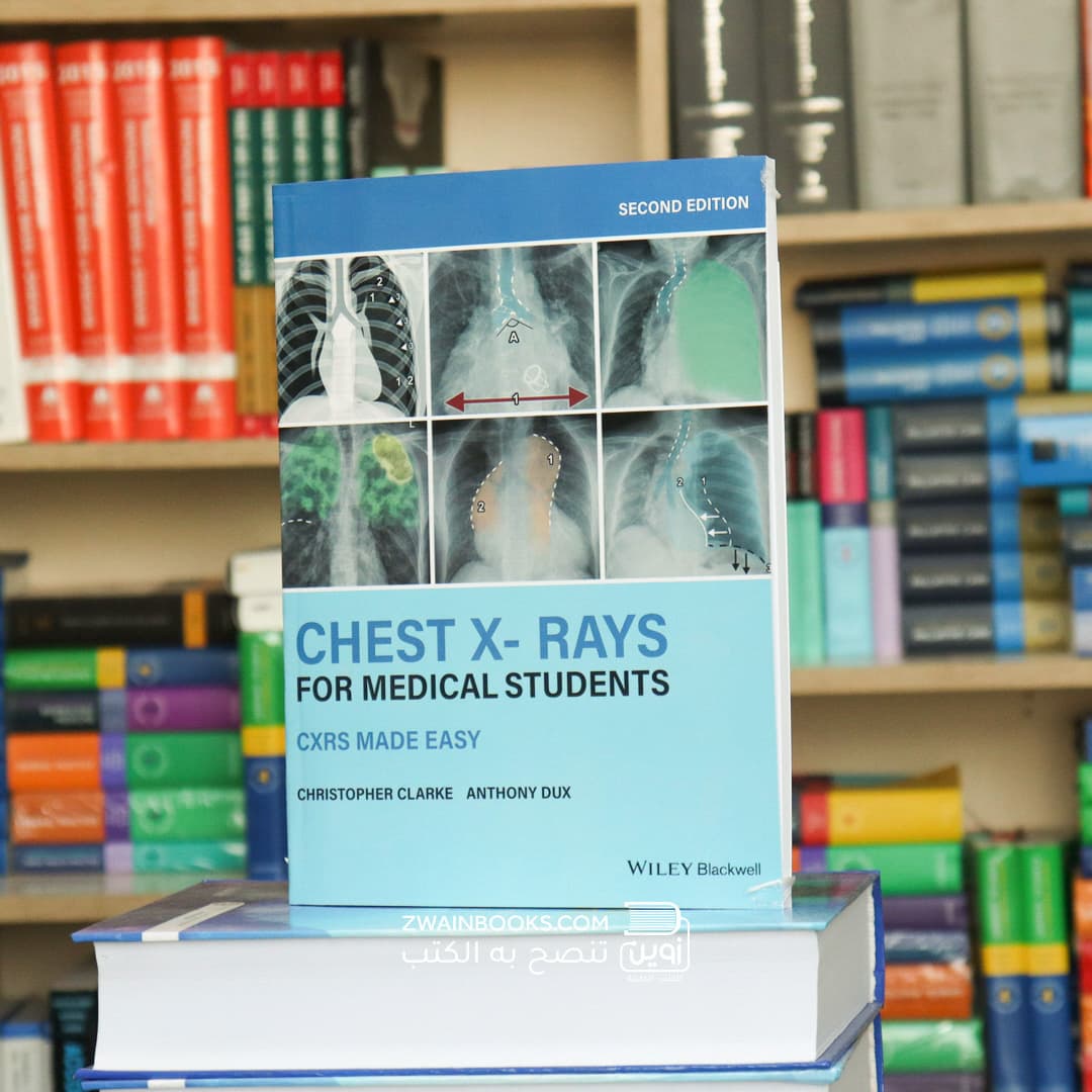 Chest X-Rays for Medical Students: CXRs Made Easy 2nd Edition
