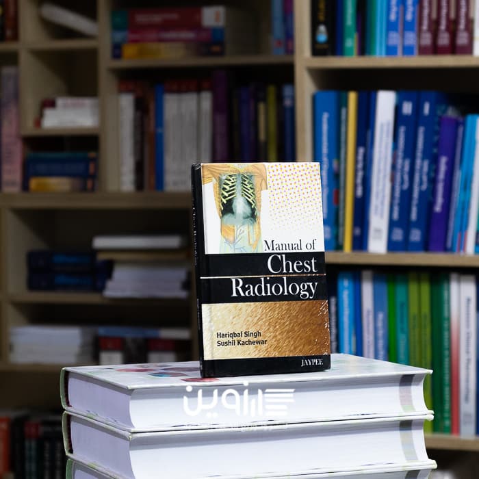 Manual of Chest Radiology