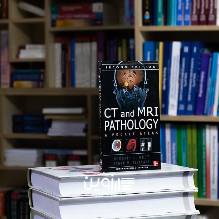 CT & MRI Pathology: A Pocket Atlas, 2nd Edition