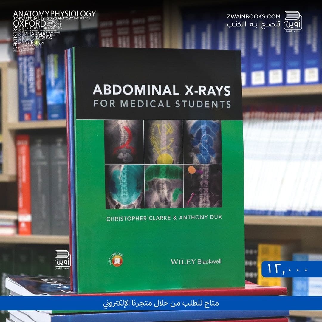 Abdominal X-rays for Medical Students
