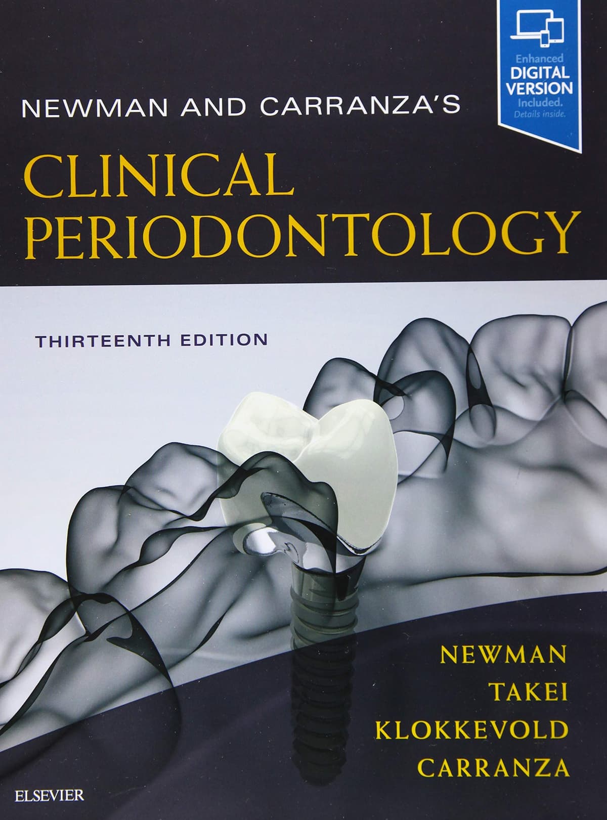 Carranza’s & Newman clinical Periodontology 13th edition 3v