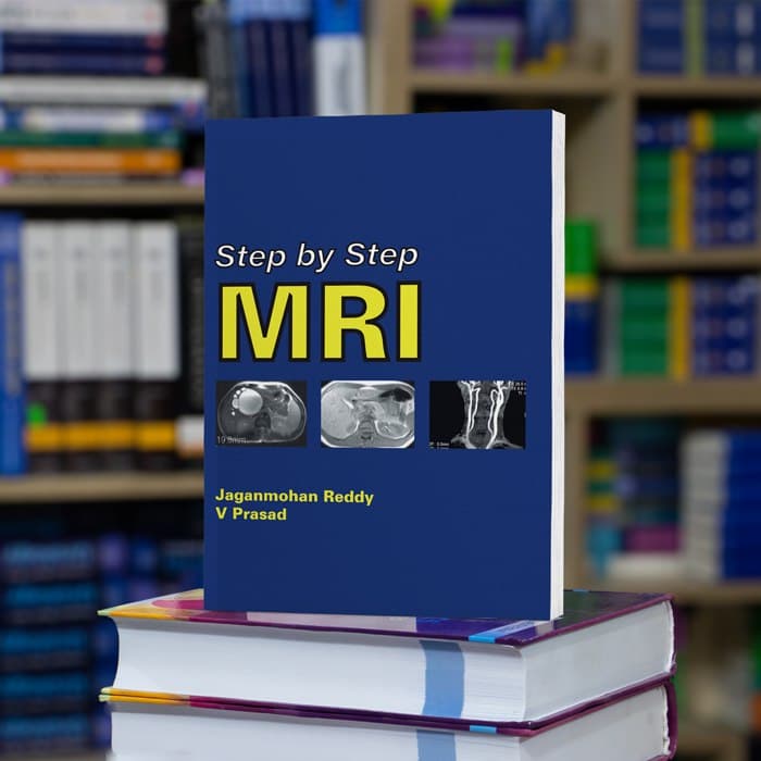 Step by step MRI