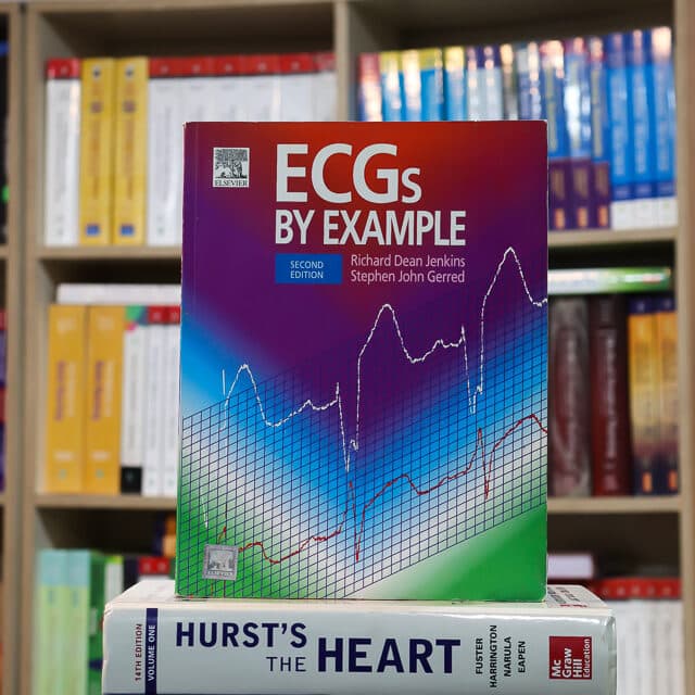 ECGs by Example